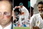 Cricketers who played with injuries