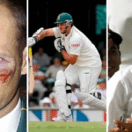 Cricketers who played with injuries