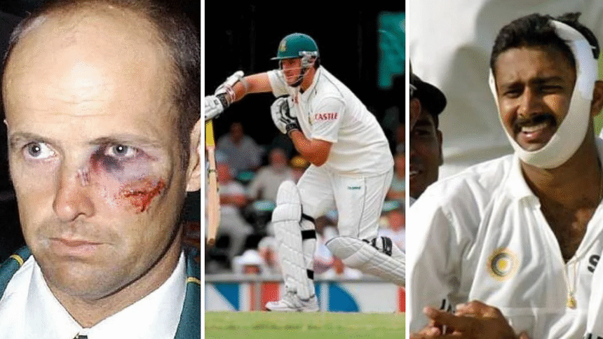 Cricketers who played with injuries